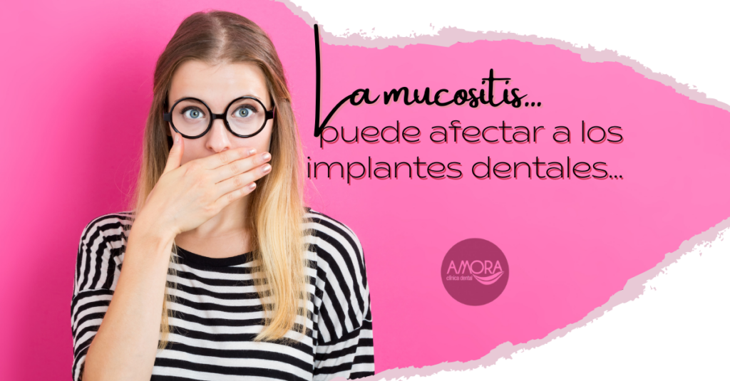 La mucositis puede afectar a los implantes dentales
