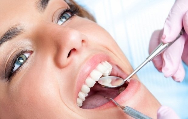 Limpieza dental periodoncia