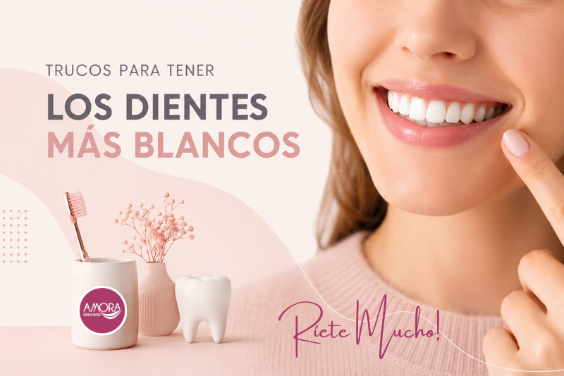 Trucos para tener los dientes más blancos