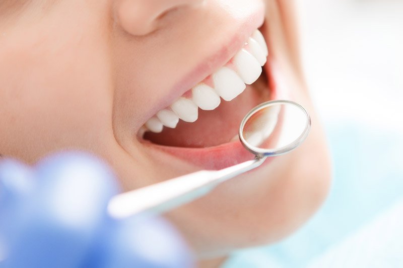 servicios dentales odontología general Clínica Dental Sabadell