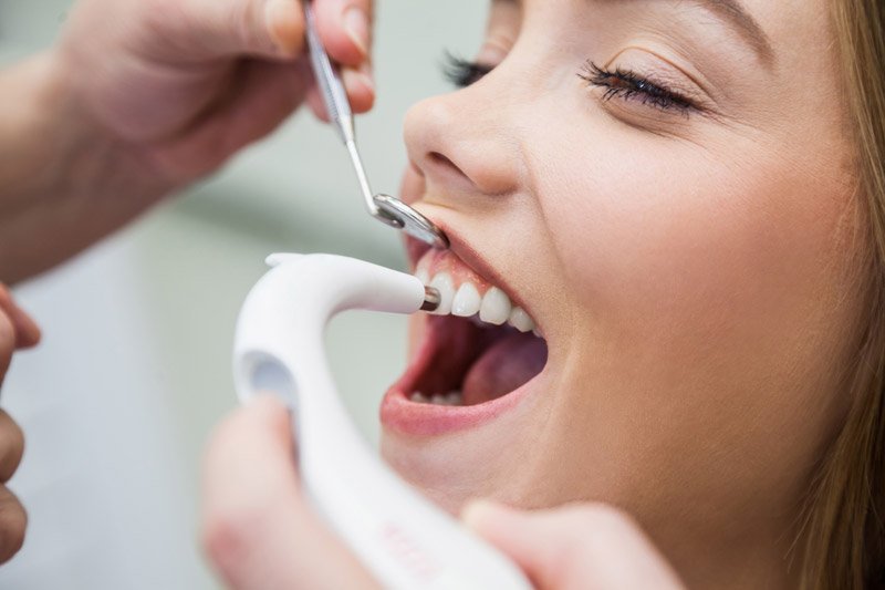 servicios dentales periodoncia Clínica Dental Sabadell